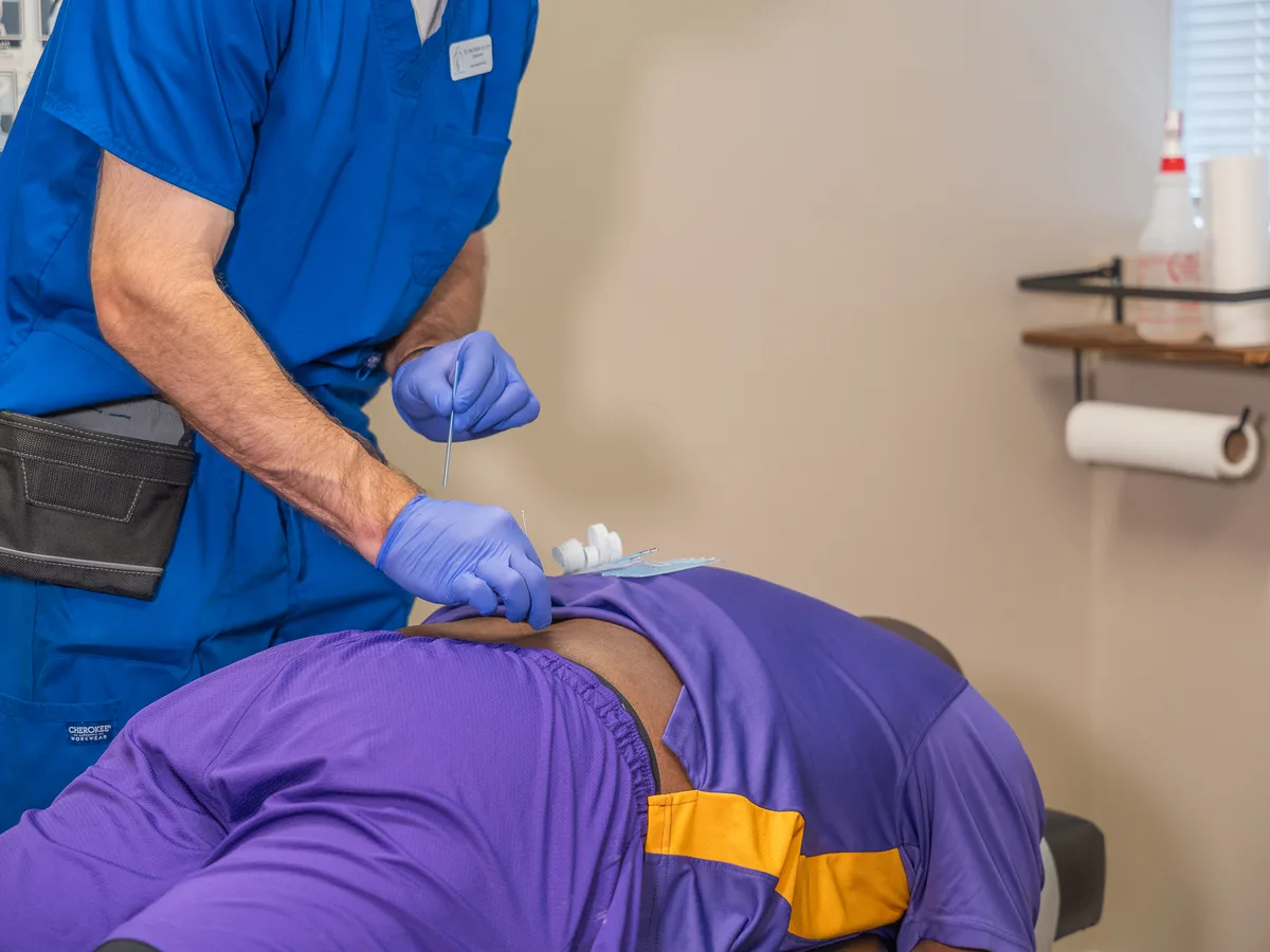 Dry Needling at Towson Integrative Health in Towson