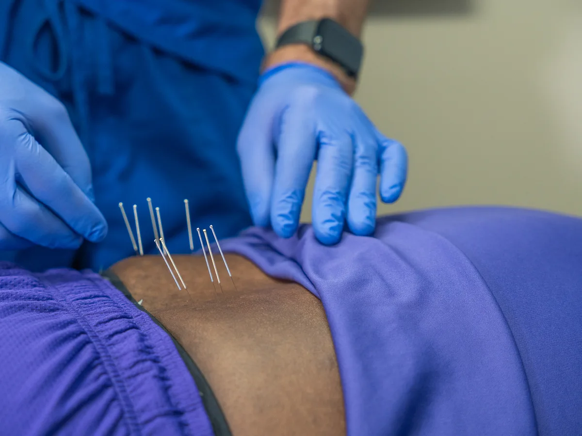 Towson Integrative Health treating fibromyalgia in Towson